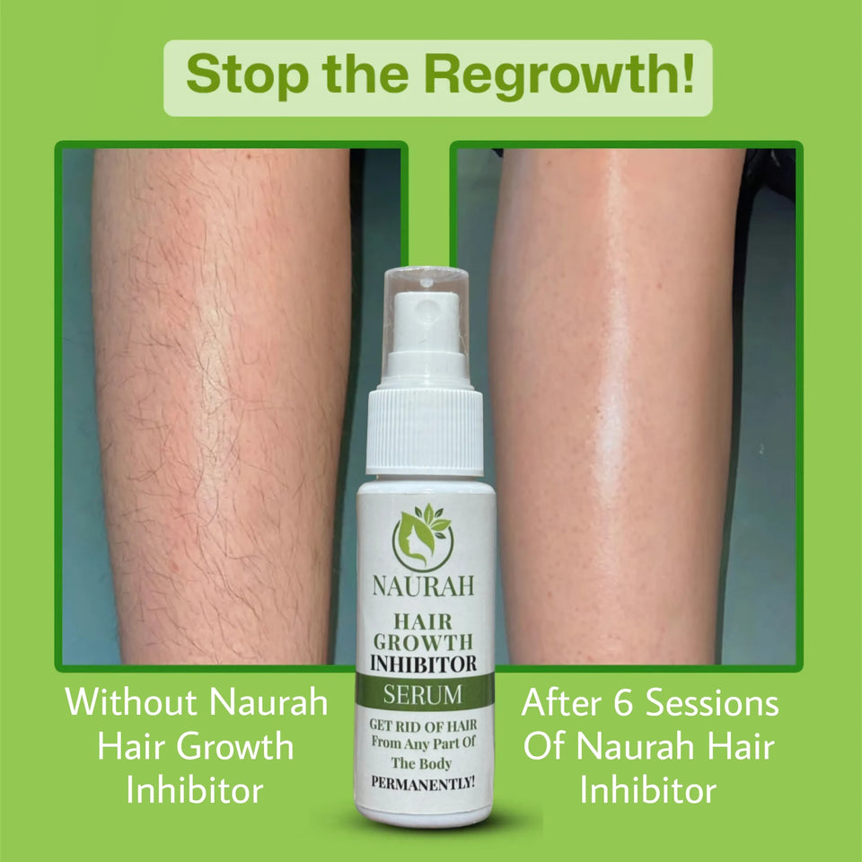 Naurah Hair Growth Inhibitor – Permanent Hair Removal Serum