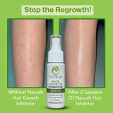 Naurah Hair Growth Inhibitor – Permanent Hair Removal Serum